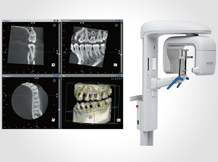 当院ではインプラントの際に歯科用CTを使用しています