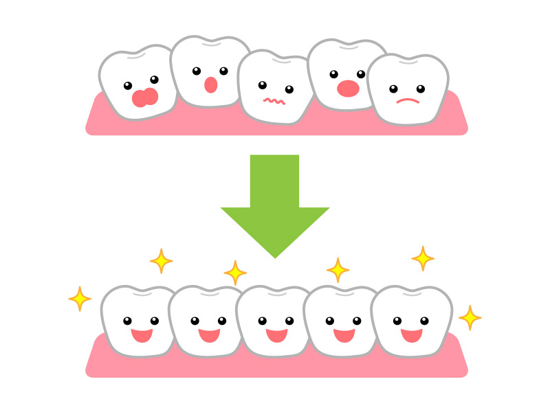 歯が移動するメカニズム